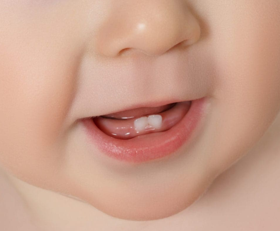 Natal Teeth: Causes, Risks, and Treatment Options