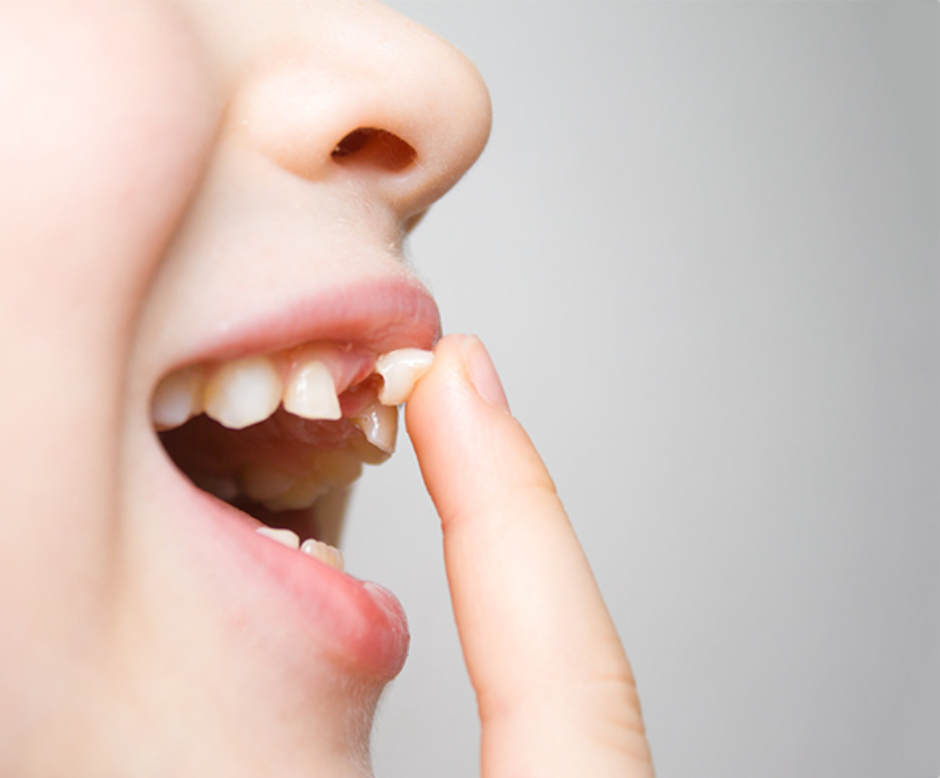 What to Do When a Baby Tooth Won't Fall Out