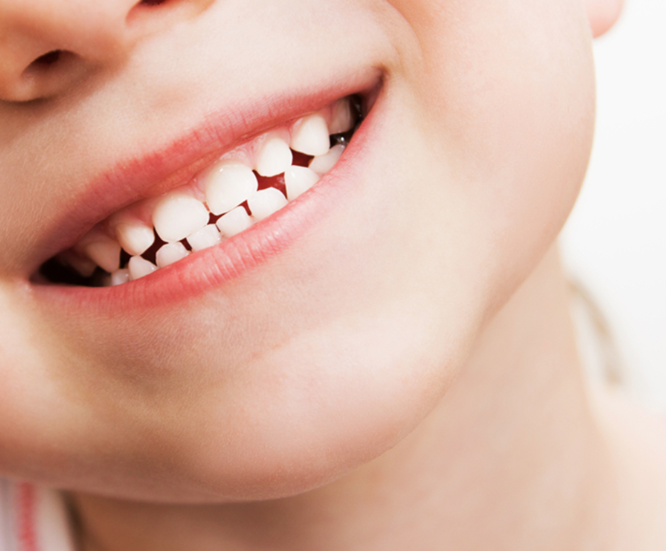 Sunny Grins: 5 Key Dental Tips for Children This Summer